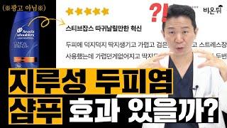 (※광고 아님※)의사가 알려주는 지루성 두피염 샴푸 총정리(뉴헤어모발성형외과 김진오)