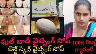 full body whitening soap 100% result guarantee/dermadew soap review 2023/best skin whitening soap