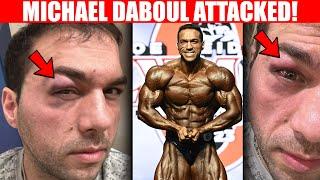 MICHAEL DABOUL ATTACK: NEW DETAILS! | Palumbo & Aceto | HMR (4/7/24)