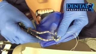 One Minute Dental Rubber dam [Dental Perspective]