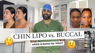 Chin Lipo vs Buccal Fat Removal WHICH IS BETTER!?