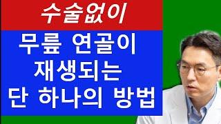 수술없이 무릎 연골이 재생되는 단 하나의 방법,  이 방법 말고는 무릎 연골이 재생되는 방법은 없습니다 (주의!!) 동영상에 수술 관련 영상이 포함돼 있습니다