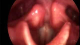 Singing Vocal Folds