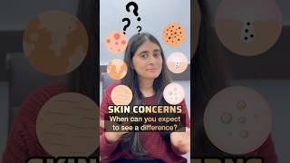 Skin concerns and results |Acne, Pigmentation,Blackheads,Whiteheads,Tanning,Wrinkles | Dermatologist