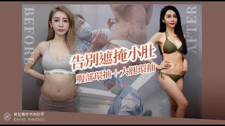 【美麗見證-腹部環抽＋大腿環抽】改善體型曲線加分