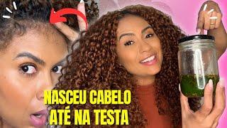 ESQUEÇA OS CABELOS GRISALHOS E CARECAS! APENAS INGREDIENTES FORTES E SEU CABELO CRESCERÁ RÁPIDO