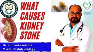 What causes kidney stones?-किडनी में पथरी बनने के कारण क्या हैं? Part 1-Dr Sumanta Mishra-Urologist