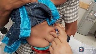 ازاي تعطي حقنة عضل لطفل عصبي_How do you give an intramuscular injection to a nervous child