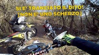 SI È TRANCIATO IL DITO NEI RAGGI DELLA MOTO! [NON È UNO SCHERZO]