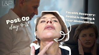 Realistic Facelift Recovery and Scar Minimization