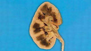 A Boy Put On A Pair Of Suspicious Socks. This Is What Happened To His Kidneys.