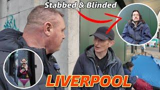 LIVERPOOL- STABBED in the EYE and now totally BLIND!!