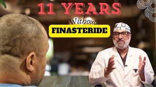 Hair Transplant in India without Finasteride | Caucasian