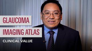 The Clinical Value of the Glaucoma Imaging Atlas – Alex Huang, MD, PhD