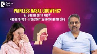 How to shrink Nasal Polyps naturally? Nasal Polyp Home Remedy - Dr.  Satish Babu K | Doctors' Circle