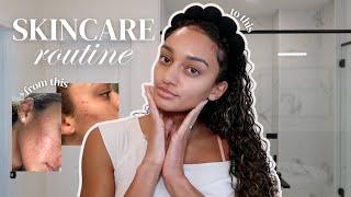 My everyday skincare routine | morning & nighttime for glowy, hydrated skin + acne prone skin!