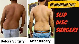 Spine surgery patient/ مريض جراحة العمود الفقري/ Пациент операции на позвоночнике/ Lumbar Slip Disc