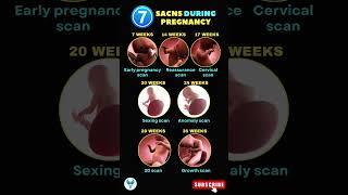 Types of Scans during Pregnancy | Anomaly Scan | 3D scan in Pregnancy #shortsvideo #pregnancy #scans