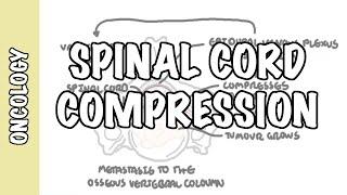 Spinal Cord Compression -  medical emergency, causes, symptoms, diagnosis, treatment