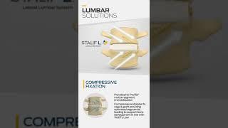 Centinel Spine Lumbar Product Portfolio 2017 Animation