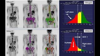 WB-MRI - Why_when_how: case-based review 2020 Update