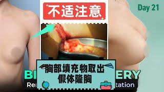 [LIVE SURGERY]直击手术现场，胸部填充物取出 +假体隆胸!!!手术过程究竟是怎样的？