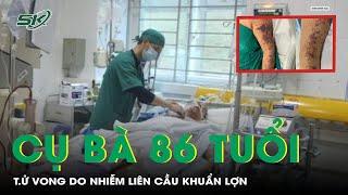 Cụ bà 86 tuổi ở Hà Nội t.ử vong do nhiễm liên cầu khuẩn lợn | SKĐS