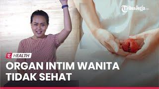 RESEP SEHAT : 5 Ciri-ciri Organ Intim Wanita Tidak Sehat