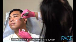 M8 Microneedling Dr. Pen Demonstration & Instruction