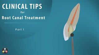 Root Canal Treatment | Clinical tips | Part 1