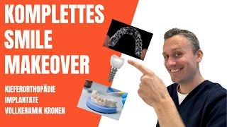 Komplettes Smile Makeover  | Zahnarzt Dr. Maximilian Fuhrmann