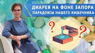 Диарея на фоне запора. Парадоксы нашего организма.