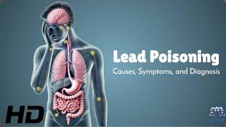 Lead Poisoning Symptoms You Can’t Ignore – Protect Your Health!