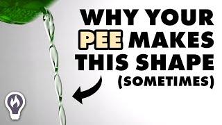 Why Your Pee Looks Like A Chain