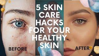 5 SKINCARE HACKS FOR YOUR HEALTHY SKIN || BEAUTIPIE ALKA