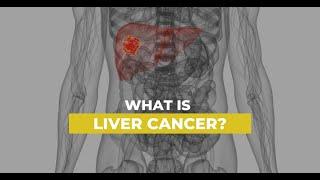 LIVER CANCER | SYMPTOMS, RISK FACTORS, PREVENTION