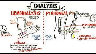 Failing Kidneys and Different Treatment Options