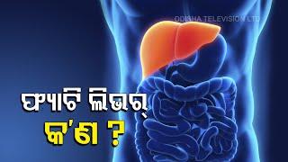 Fatty Liver- Causes, Symptoms & Diagnosis