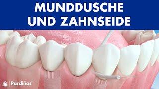 Munddusche und Zahnseide: Implantat-Pflege ©