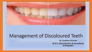 Tooth  whitening: Yellow teeth,   "From Diagnosis to Treatment:  Tooth Discoloration Management