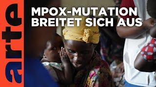 DR Kongo: Die Mpox-Epidemie | ARTE Reportage