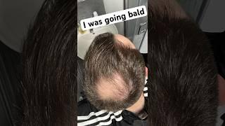 Balding Man Goes Full Joe Rogan Bald #balding #baldcafe #headshave