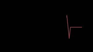 15 секунд до остановки сердца #cardio #сердце #медицина #жизнь #жиза #топ
