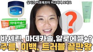 마데카솔 사용자 99%가 모르는 주름, 미백, 보습, 트러블 한방에 잡는 마데카솔겔 바세린 알로에젤 팩 방법 / 효과 미쳤다/ 돈 한 푼 안 들이고 0원  '이것' 으로 -20살!