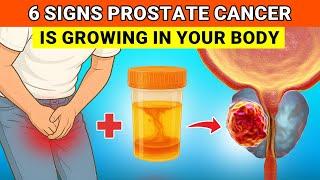 Don't Miss These 6 Subtle Signs of Prostate Cancer - This Could Save Your Life!