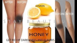 DARK KNEES AND ELBOW|GET RID OF DARK KNEES AND ELBOWS|GET FAIR KNEES AND ELBOWS AT HOME FAST RESULT