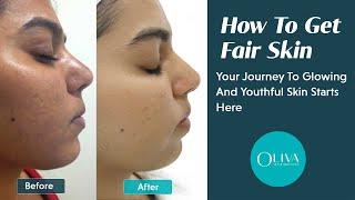 Fair Skin Secrets Revealed - Myths, Facts, And Treatment Options