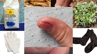 Cracks  on fingers  hands. Cold dermatitis (dermatitis).