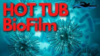 How To Remove BioFilm From a Hot Tub