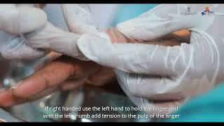 Nail care|Palliative care Skill Video (English)